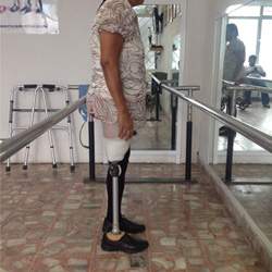 Diplomado en Rehabilitación Protésica del Miembro Inferior